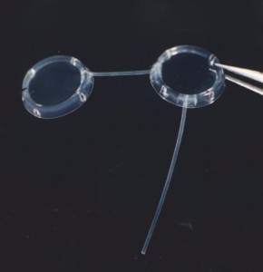 Molteno® Double Plate Implant (right eye shown)