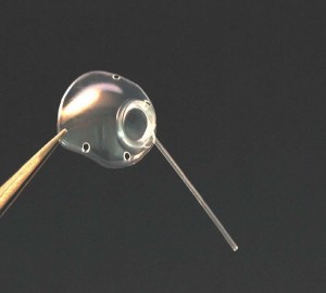 Molteno3® G-series implant oblique view