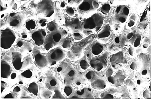 Porous M-Sphere® matrix is rapidly incorporated into the tissues